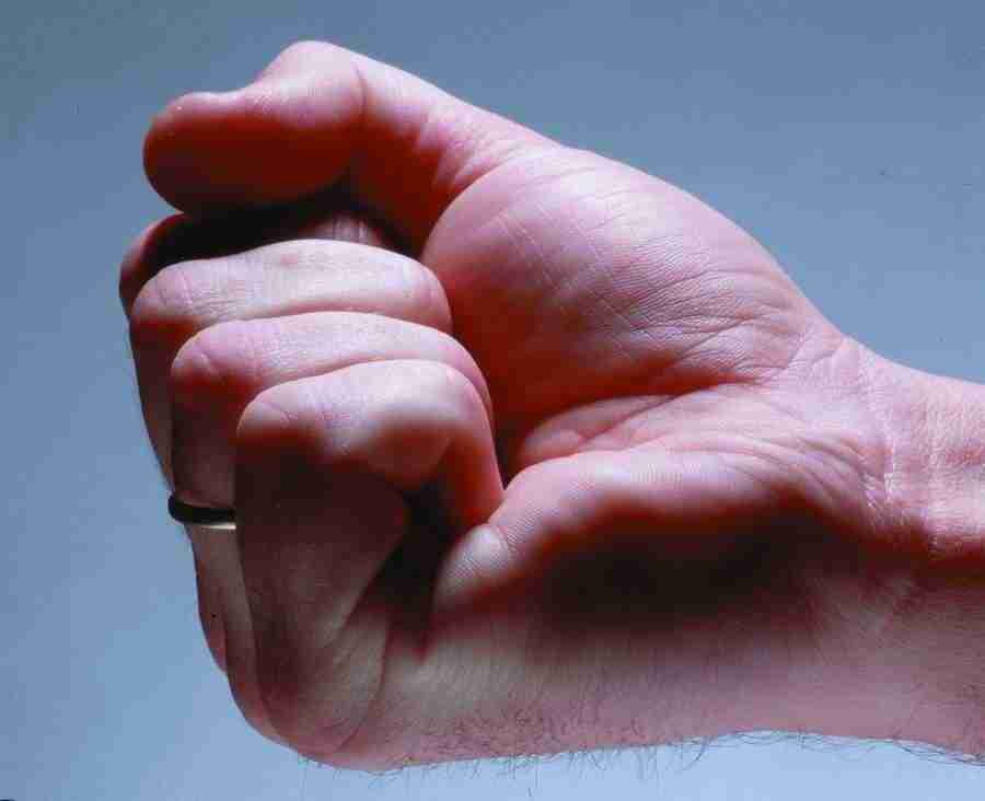 Anatomy Ice and Illusions - BackArts ></a>
<script language=JavaScript> 
  var txt = 