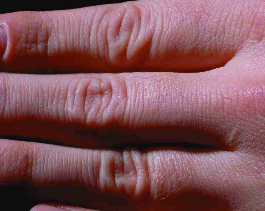 Anatomy Ice and Illusions - BackArts ></a>
<script language=JavaScript> 
  var txt = 
