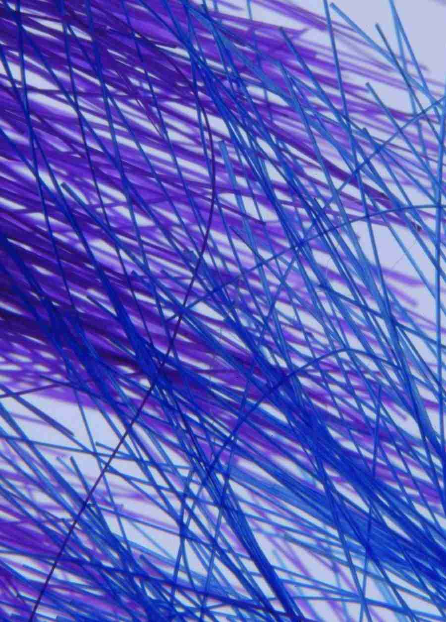 Anatomy Ice and Illusions - BackArts ></a>
<script language=JavaScript> 
  var txt = 