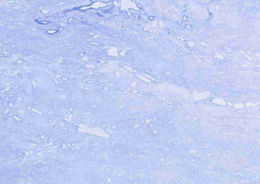 Stones - Datacraft Sozaijiten  ></a>
<script language=JavaScript> 
  var txt = 