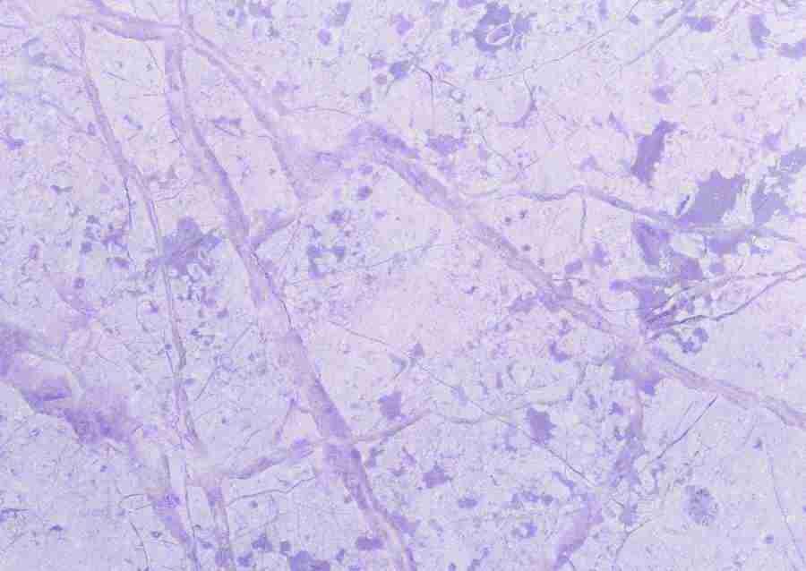 Stones - Datacraft Sozaijiten  ></a>
<script language=JavaScript> 
  var txt = 