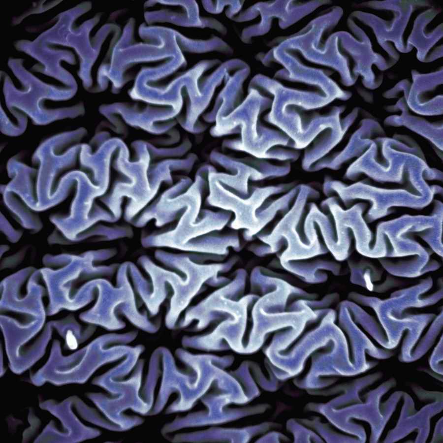 Electron Microscapes - Photodisc Background Series ></a>
<script language=JavaScript> 
  var txt = 