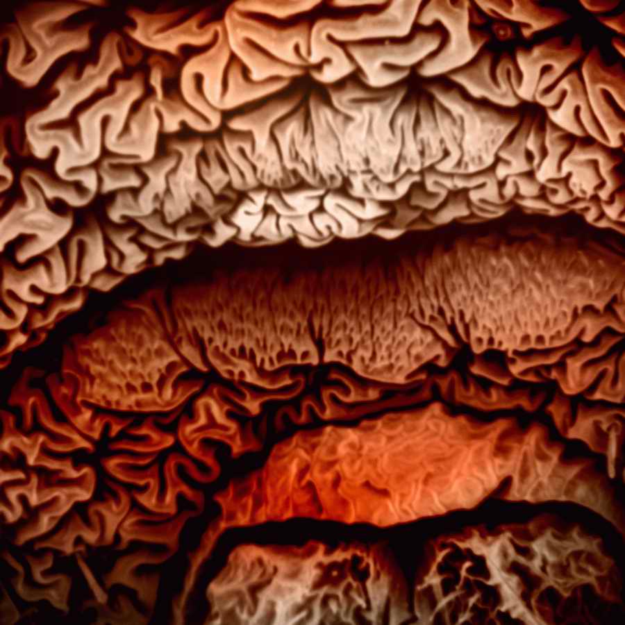 Electron Microscapes - Photodisc Background Series ></a>
<script language=JavaScript> 
  var txt = 