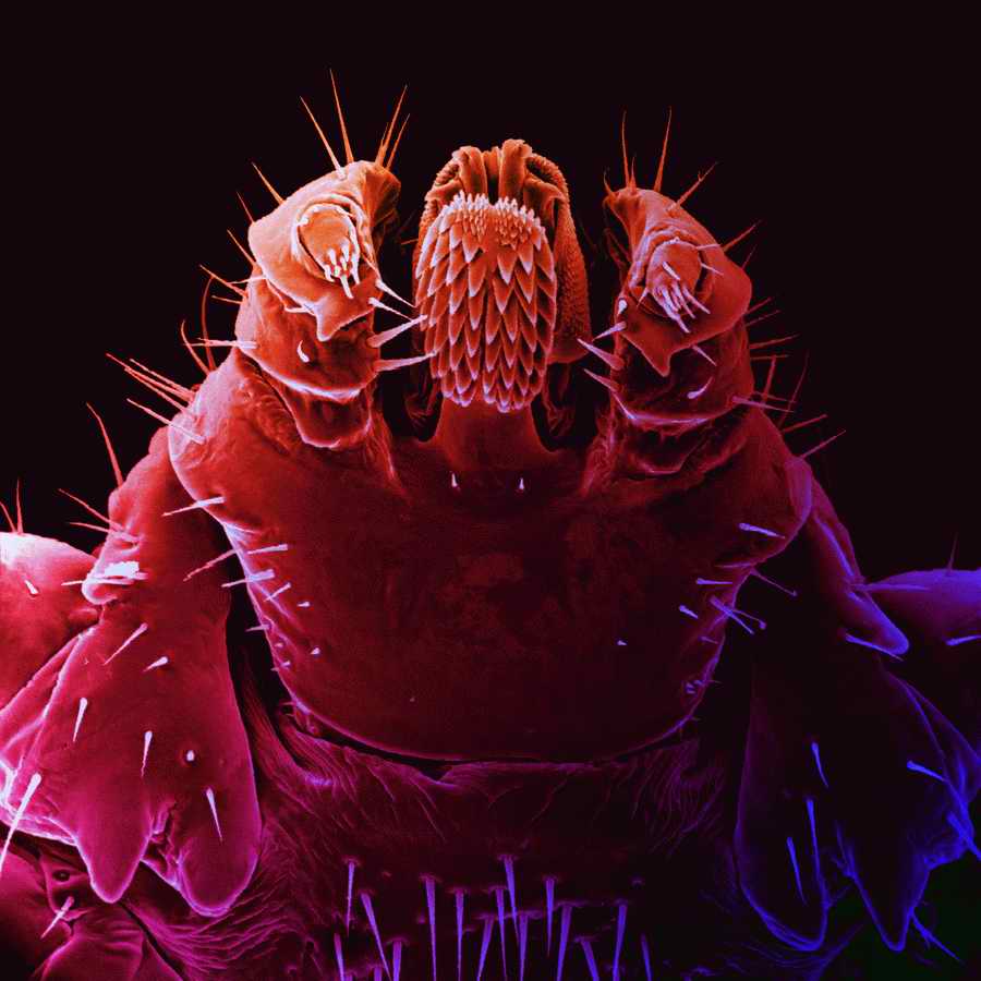Electron Microscapes - Photodisc Background Series ></a>
<script language=JavaScript> 
  var txt = 