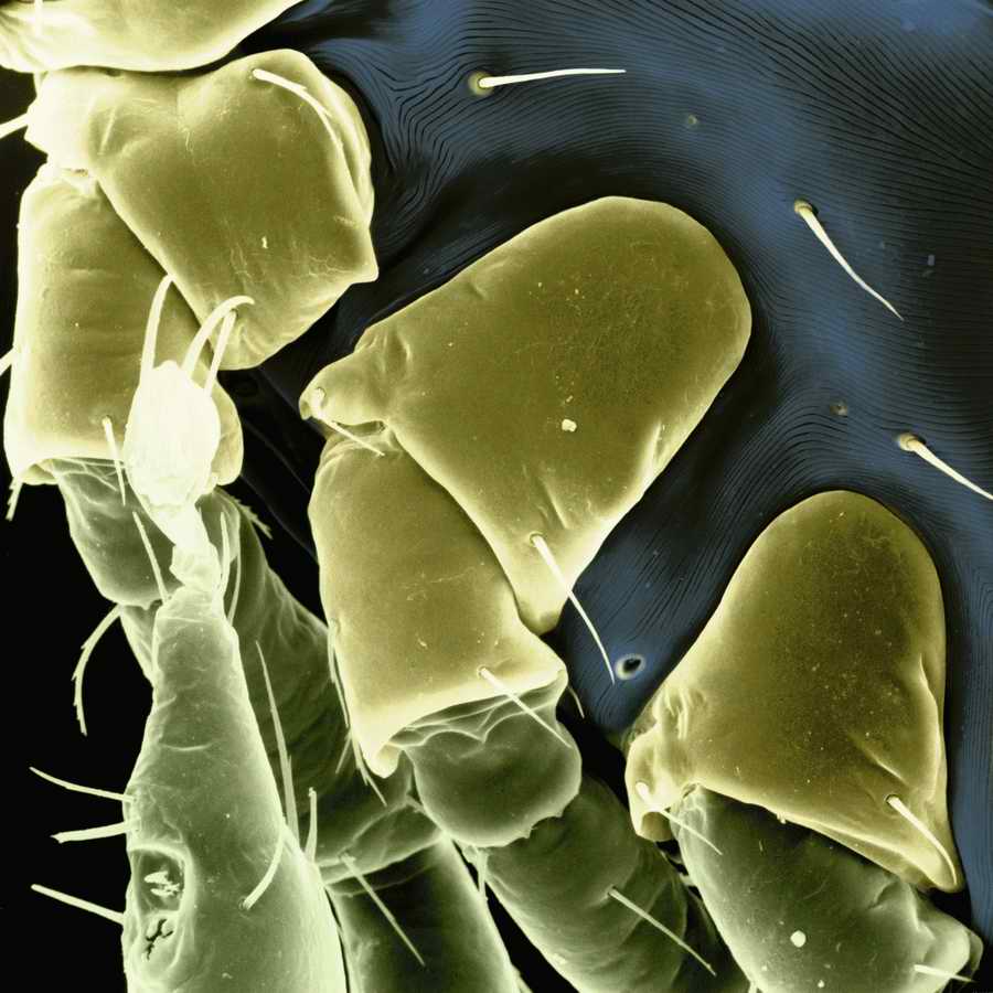 Electron Microscapes - Photodisc Background Series ></a>
<script language=JavaScript> 
  var txt = 