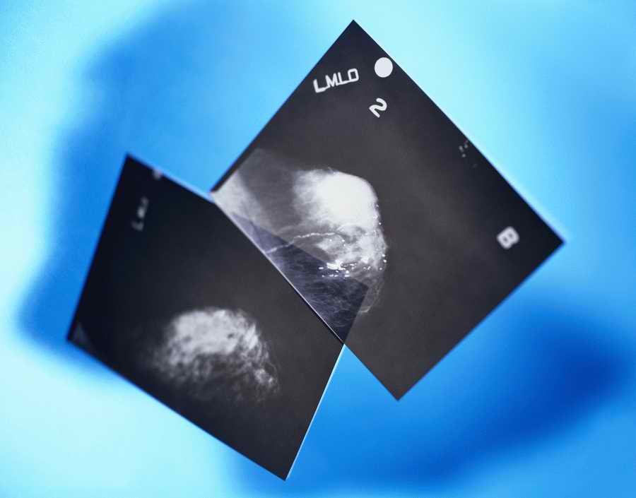 Professional Science - Photodisc ></a>
<script language=JavaScript> 
  var txt = 