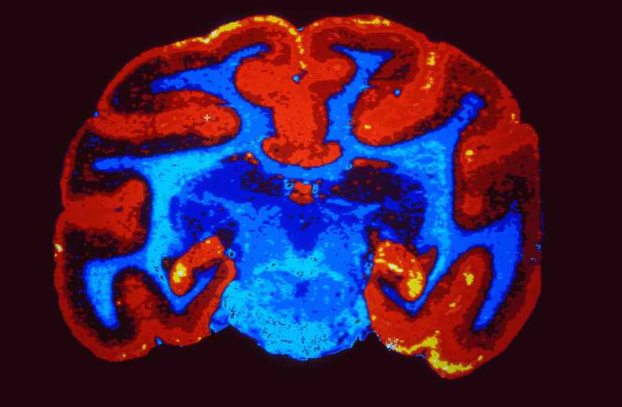 Science, Technology & Medicine - Photodisc ></a>
<script language=JavaScript> 
  var txt = 