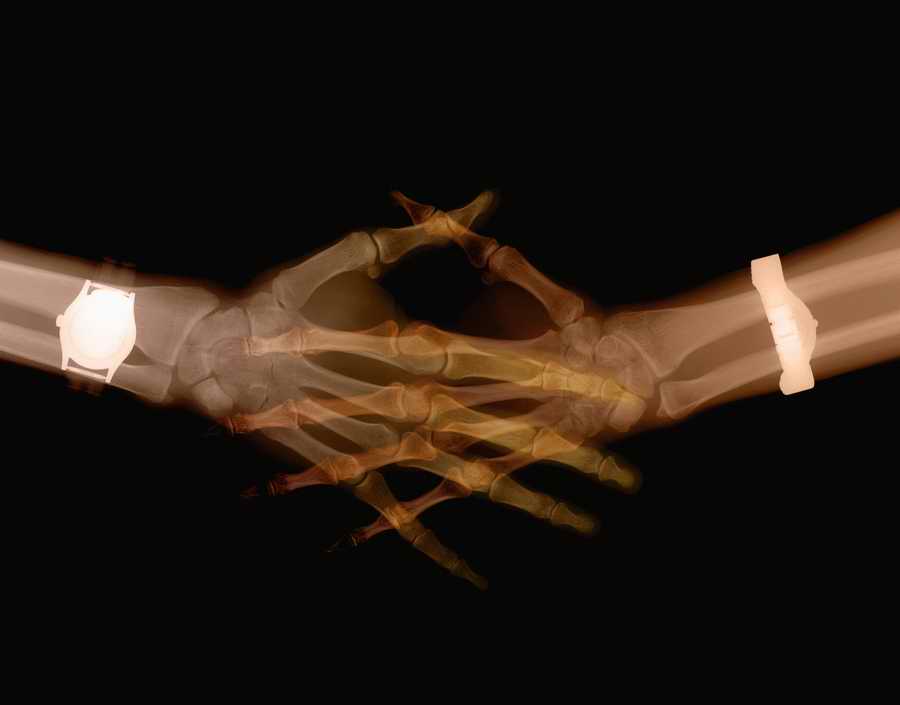 X-Ray Vision - Photodisc Signature Series ></a>
<script language=JavaScript> 
  var txt = 