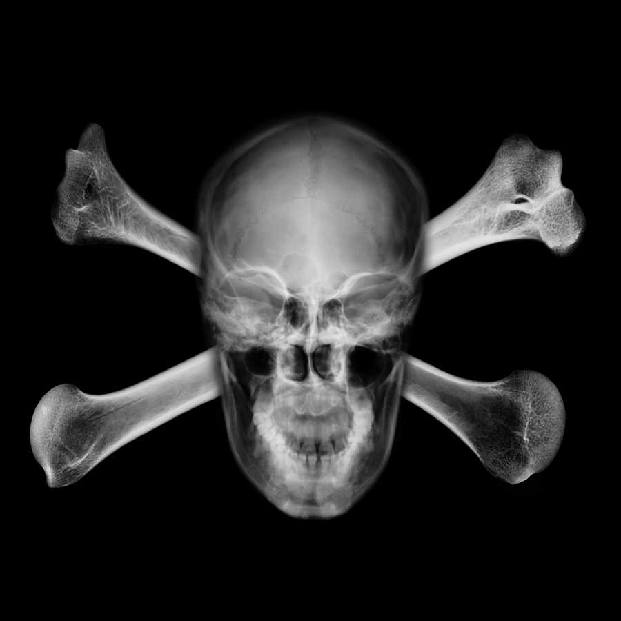 X-Ray Vision - Photodisc Signature Series ></a>
<script language=JavaScript> 
  var txt = 